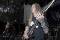 VULVODYNIA